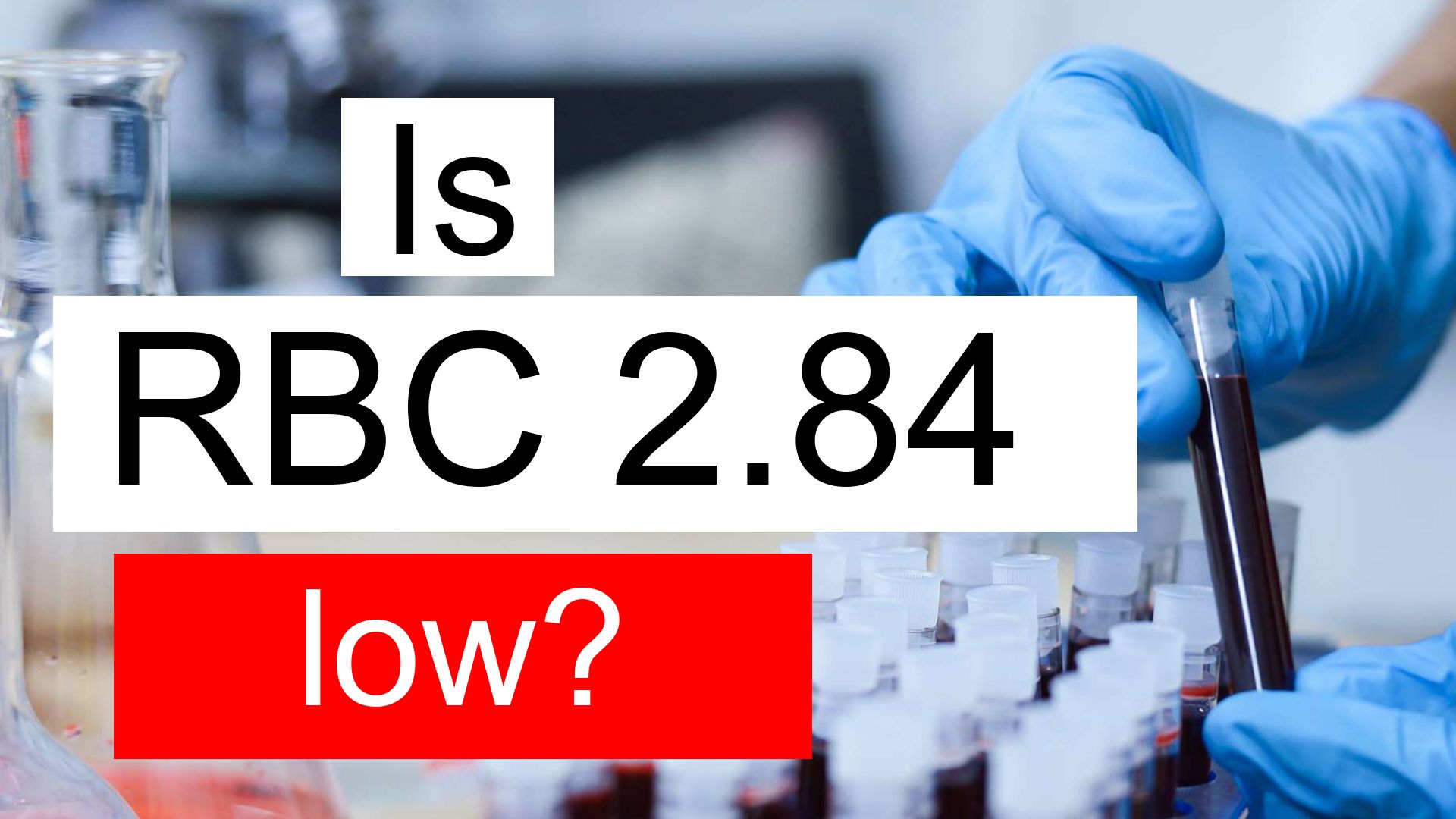 is-rbc-2-84-low-normal-or-dangerous-what-does-red-blood-cell-count