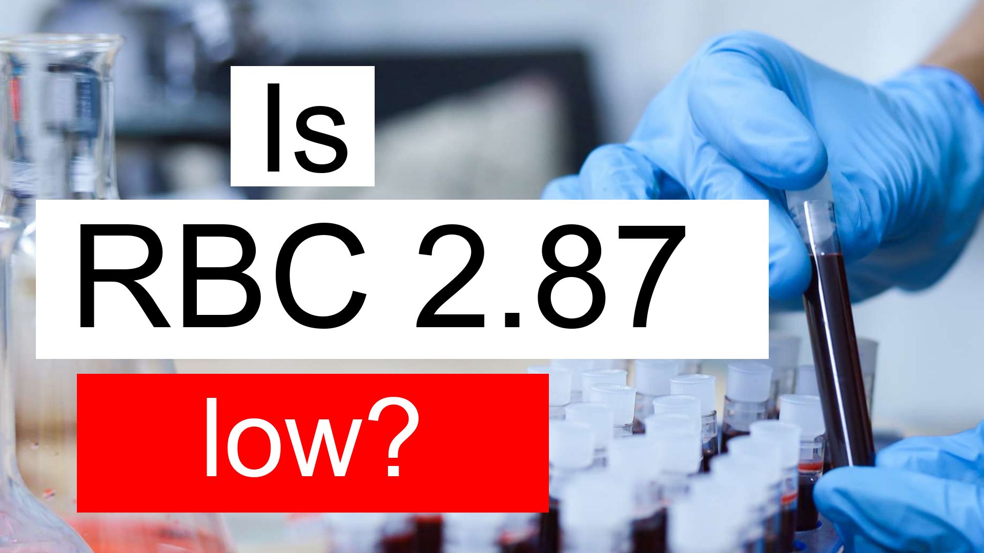 is-rbc-2-87-low-normal-or-dangerous-what-does-red-blood-cell-count-level-2-87-mean