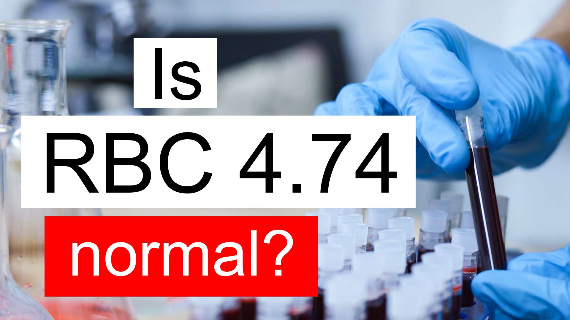 Is RBC 4 74 Normal High Or Low What Does Red Blood Cell Count Level 4 