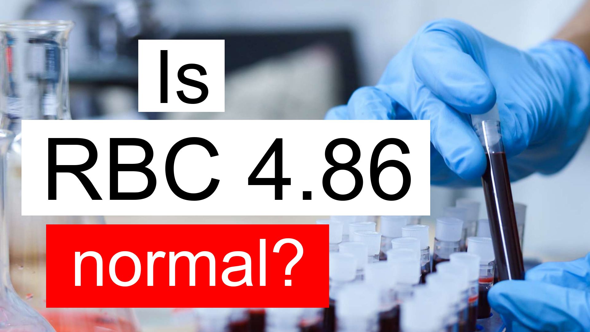 is-rbc-4-86-normal-high-or-low-what-does-red-blood-cell-count-level-4-86-mean