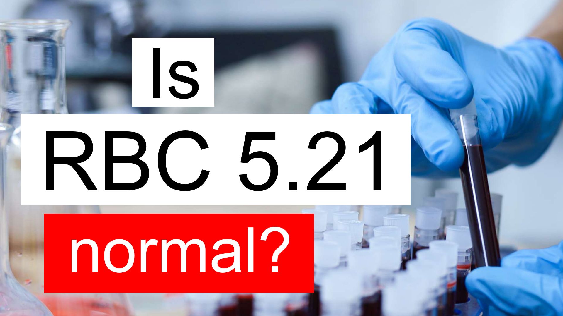 is-rbc-5-21-normal-high-or-low-what-does-red-blood-cell-count-level-5