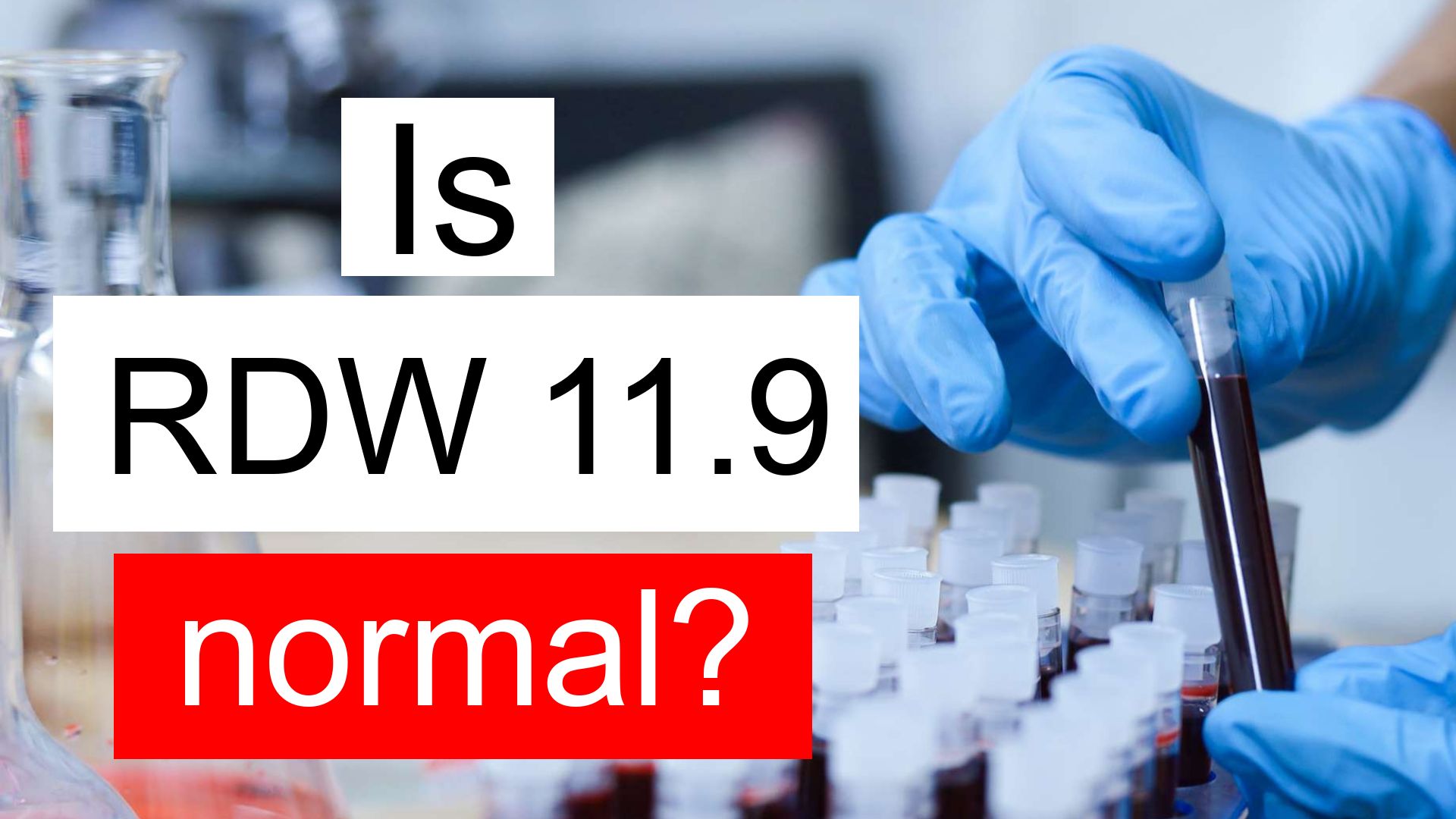 Is RDW 11 9 Normal High Or Low What Does Red Cell Distribution Width 