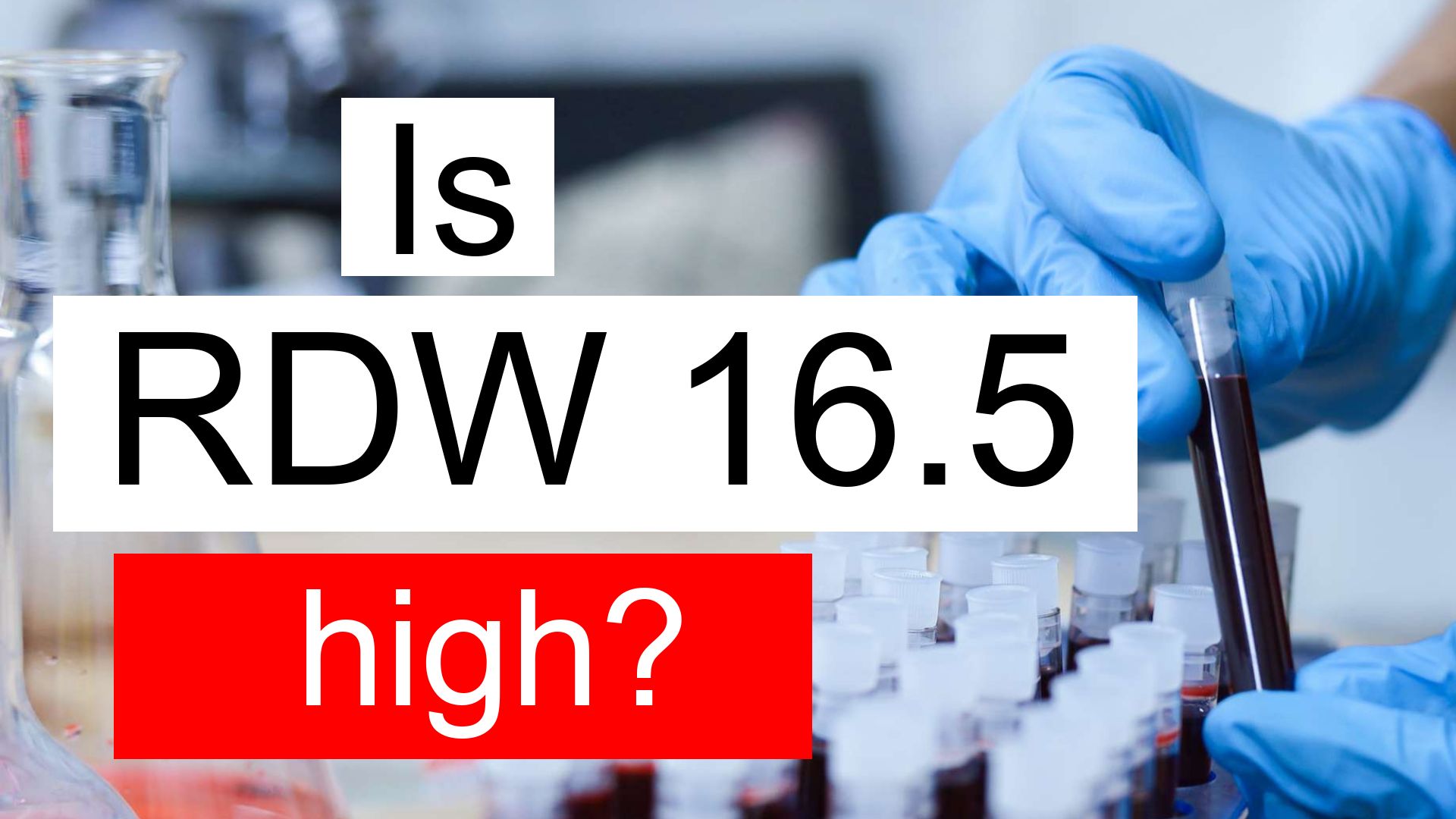 Is RDW 16.5 high, normal or dangerous? What does Red cell distribution