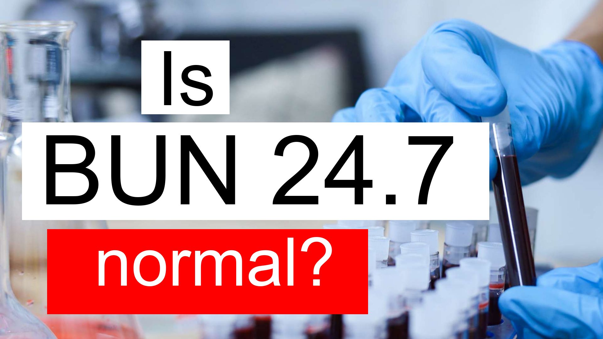 is-serum-bun-24-7-high-normal-or-dangerous-what-does-serum-bun-level