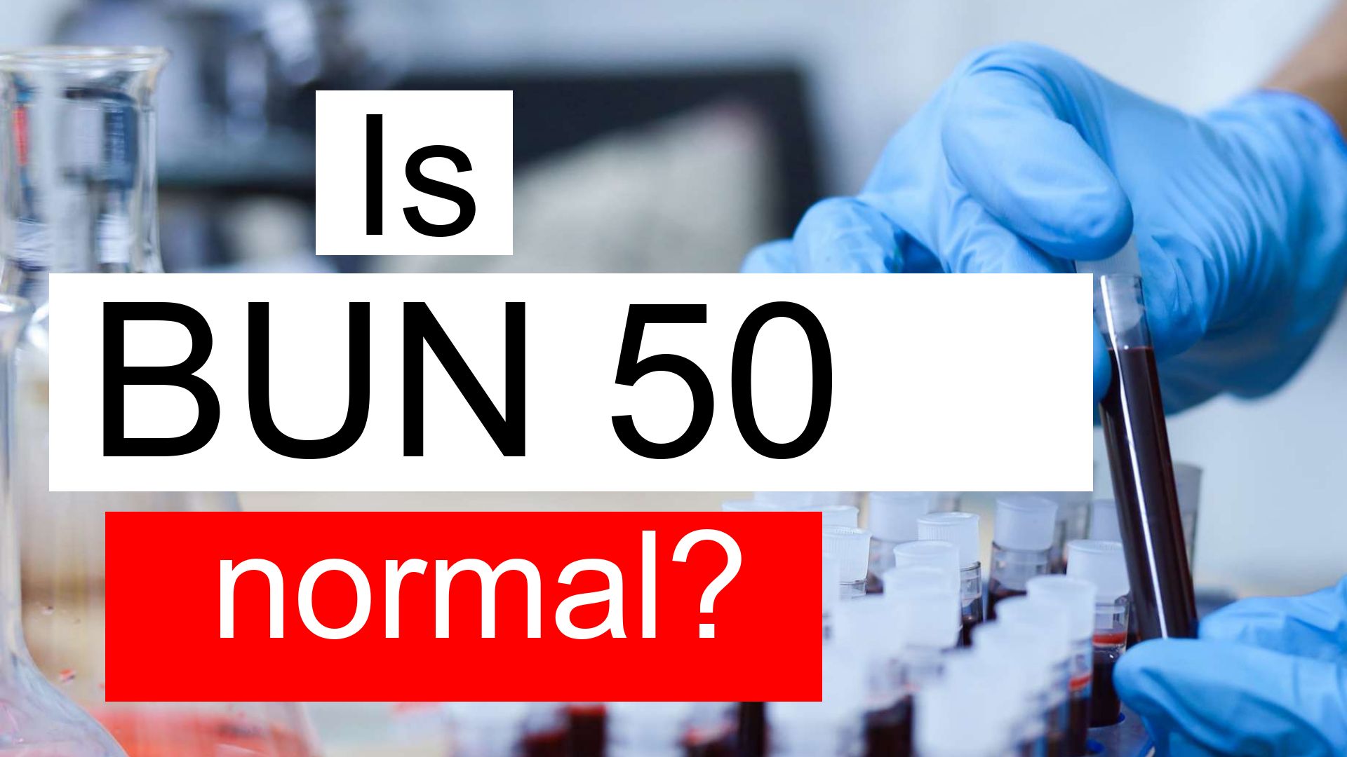 is-serum-bun-50-high-normal-or-dangerous-what-does-serum-bun-level-50