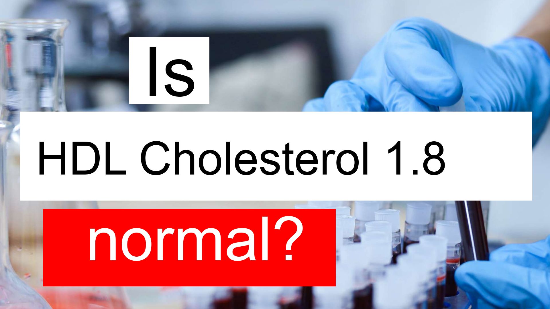 Is Serum HDL Cholesterol 1 8 High Normal Or Dangerous What Does Serum 