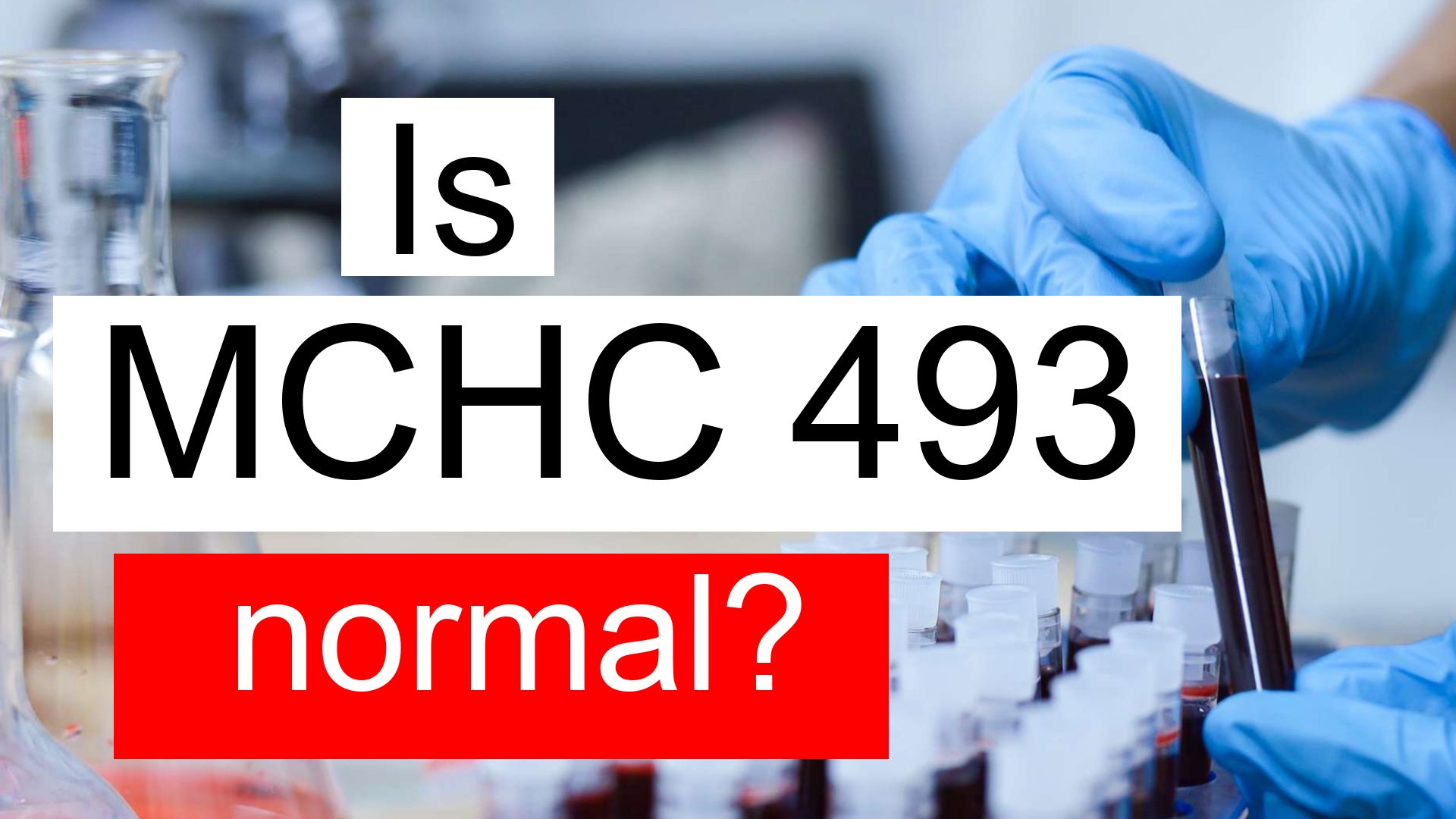 is-serum-mchc-493-high-normal-or-dangerous-what-does-serum-mchc-level-493-mean