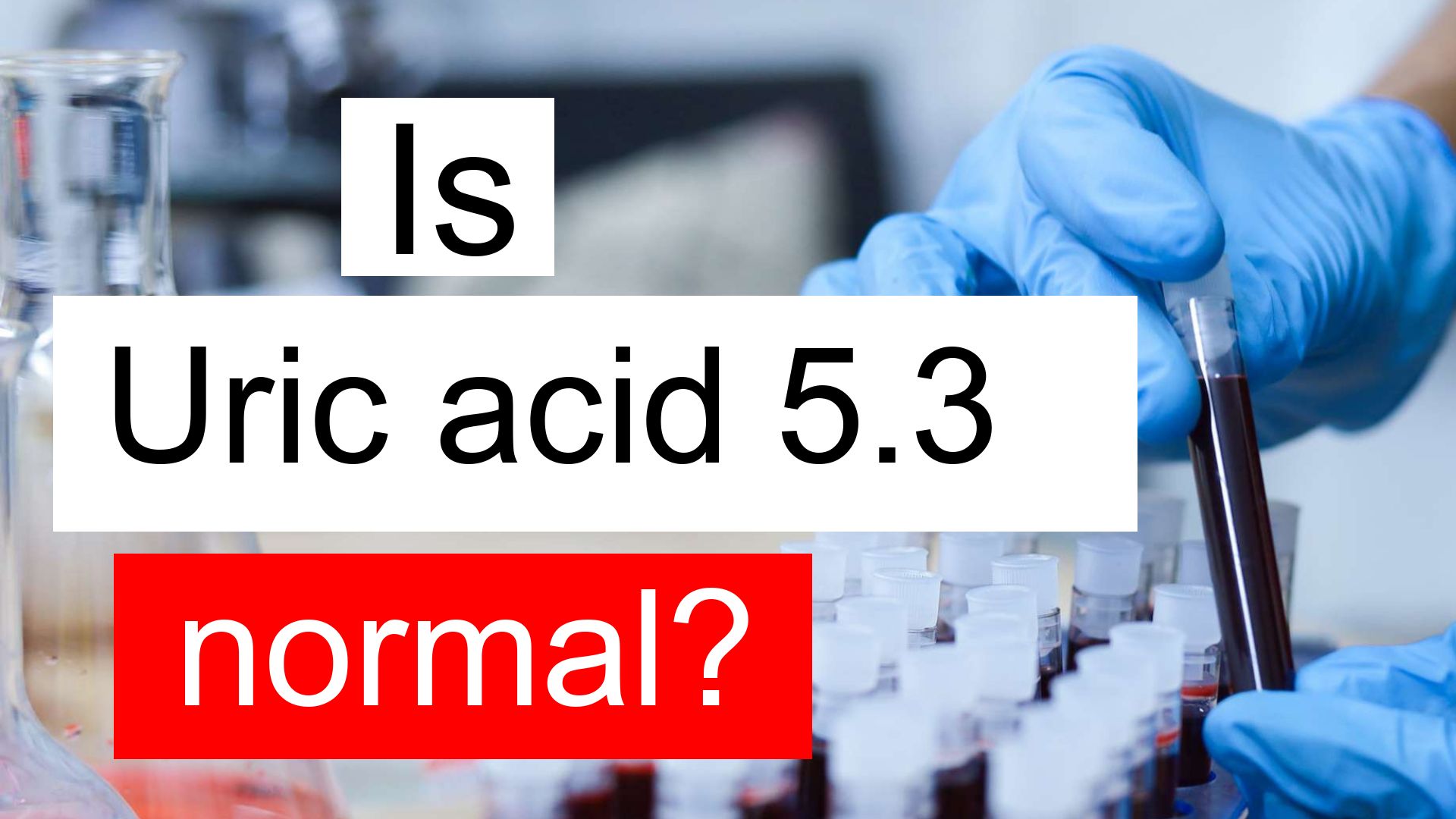 Is Uric acid 5.3 normal, high or low? What does Uric acid level 5.3 mean?