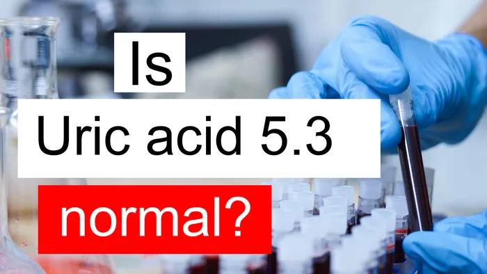 Uric acid 5.3