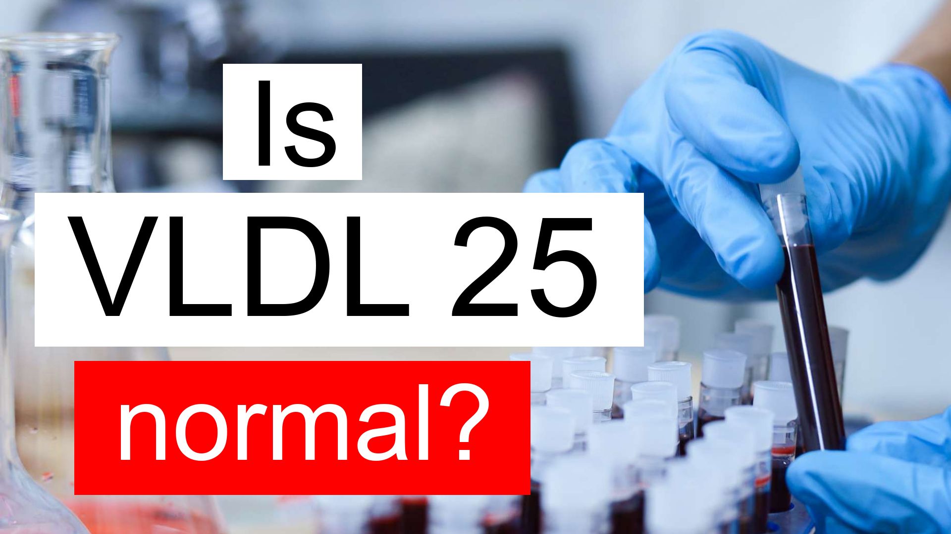 is-vldl-25-normal-high-or-low-what-does-very-low-density-lipoprotein