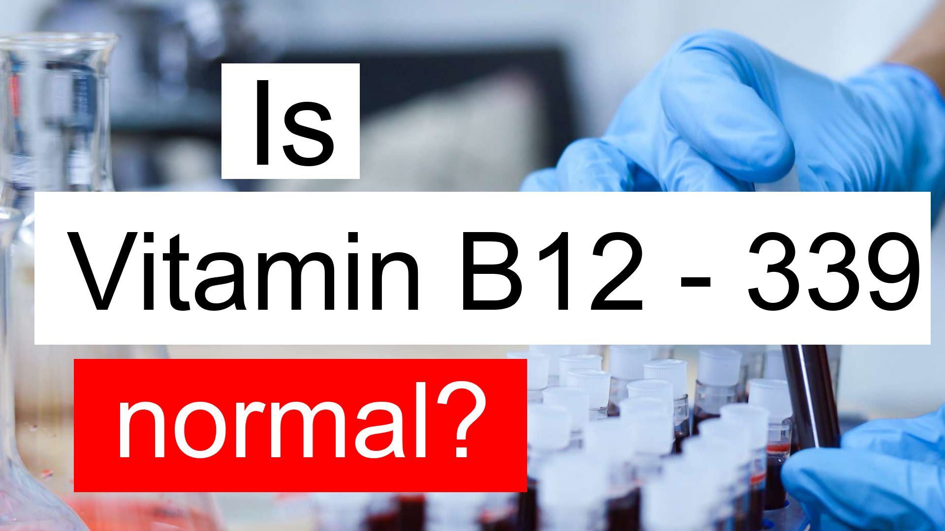 is-vitamin-b12-339-normal-high-or-low-what-does-vitamin-b12-level-339