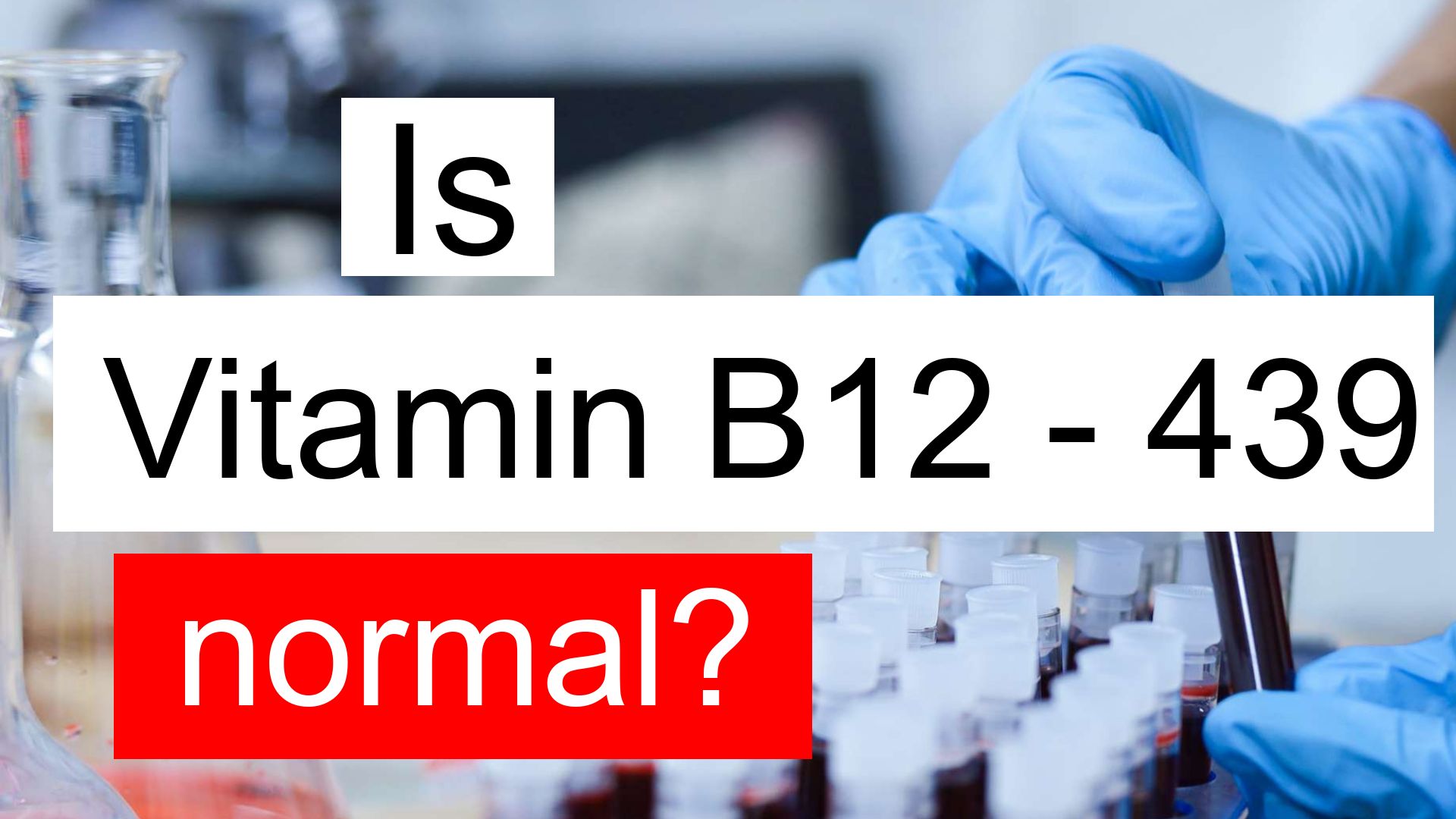 is-vitamin-b12-439-normal-high-or-low-what-does-vitamin-b12-level-439