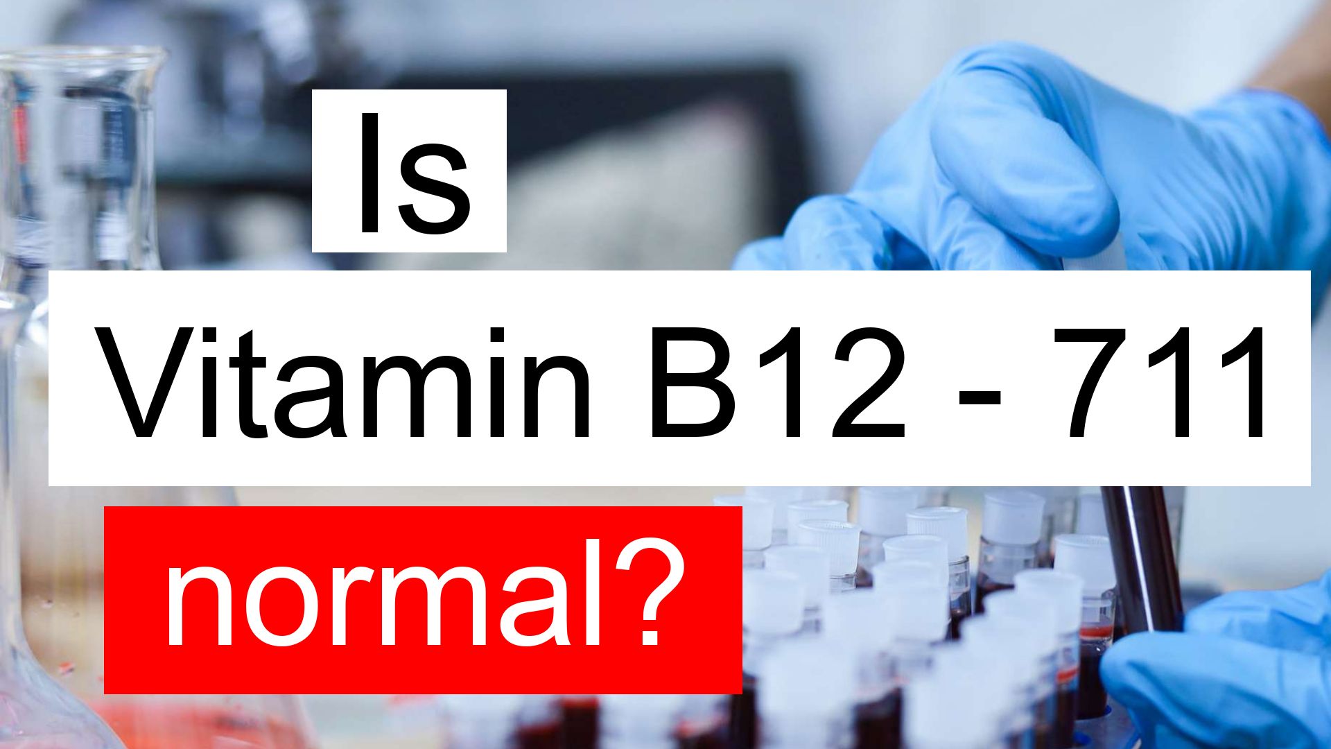 is-vitamin-b12-711-normal-high-or-low-what-does-vitamin-b12-level-711