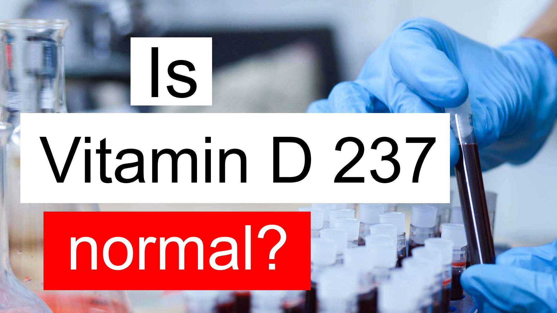 is-vitamin-d-237-normal-high-or-low-what-does-vitamin-d-level-237-mean