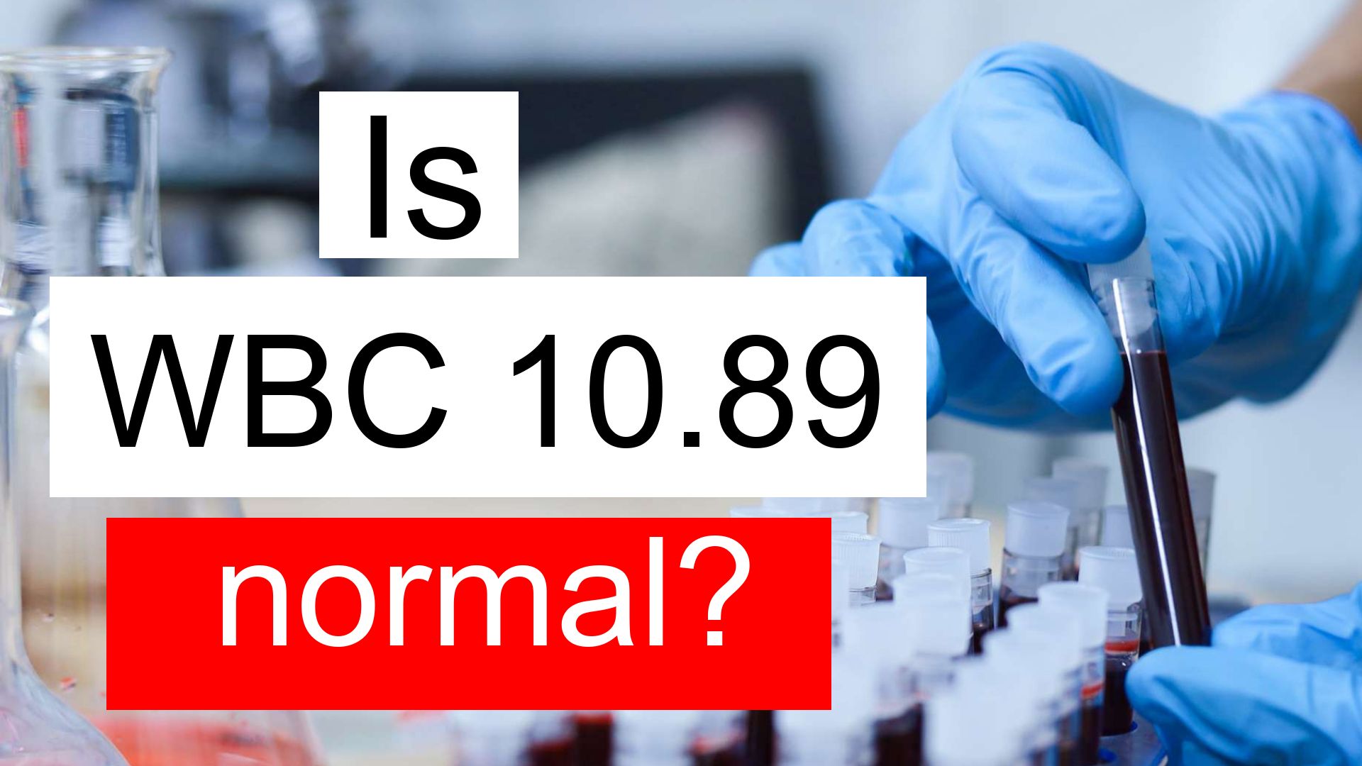 is-wbc-10-89-normal-high-or-low-what-does-white-blood-cell-count